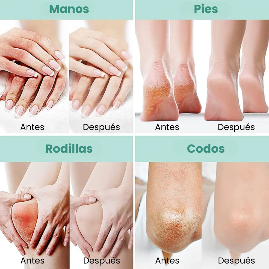 CREMA UREA REPARADORA 40%